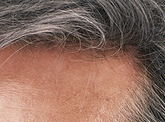 生え際の髪の毛　ロマンスグレーの画像　写真